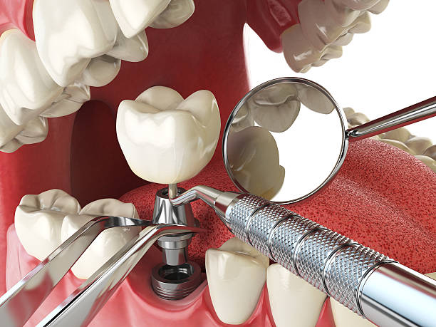 Best Emergency Broken Tooth Repair in Grapeland, TX